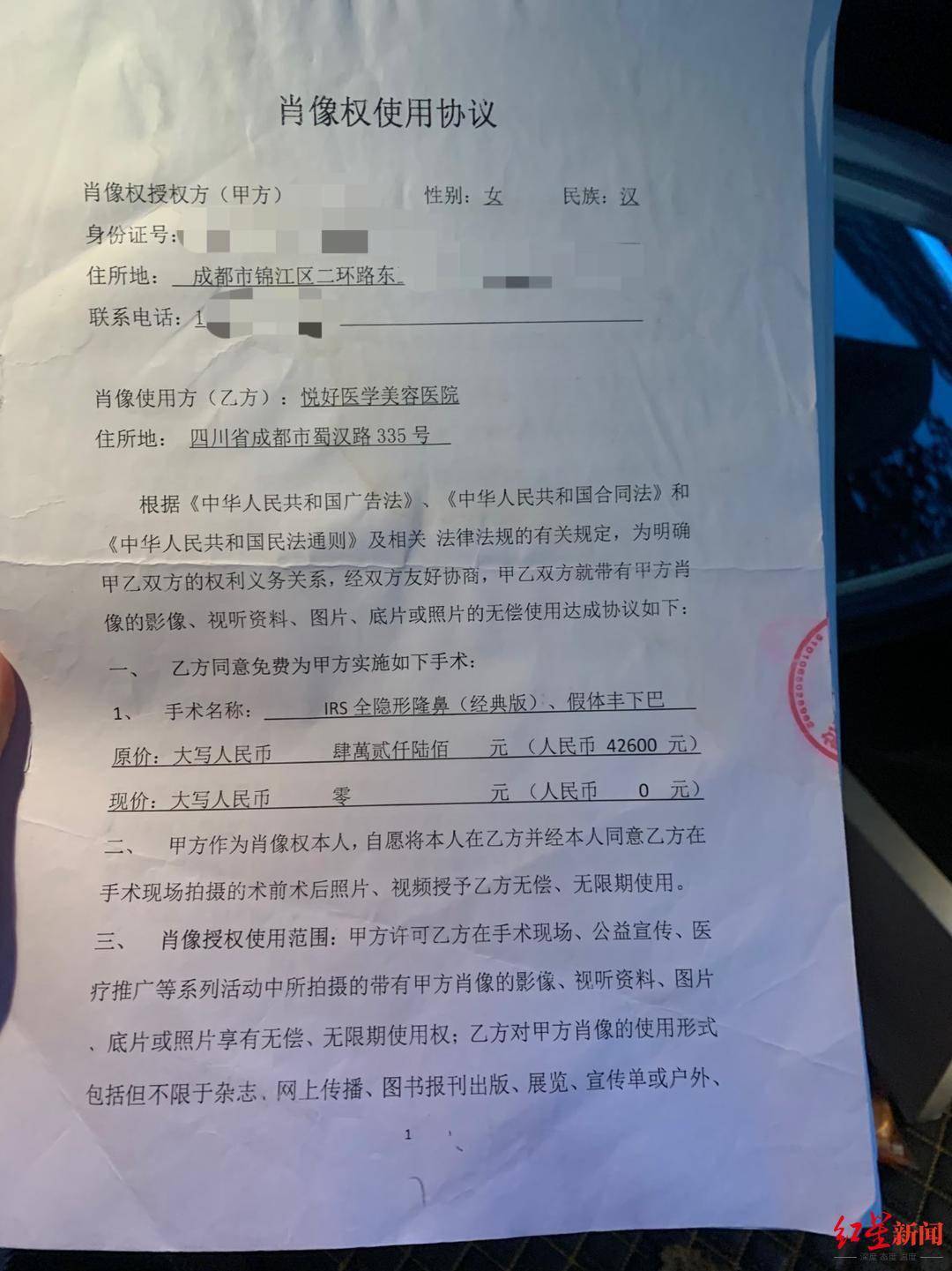 恒达官网整形悲剧:“成都赵丽颖”没当成,鼻子还变形 院方:手术确实出了问题 (图3) 恒达官网整形悲剧:“成都赵丽颖”没当成,鼻子还变形 院方:手术确实出了问题 (图3)