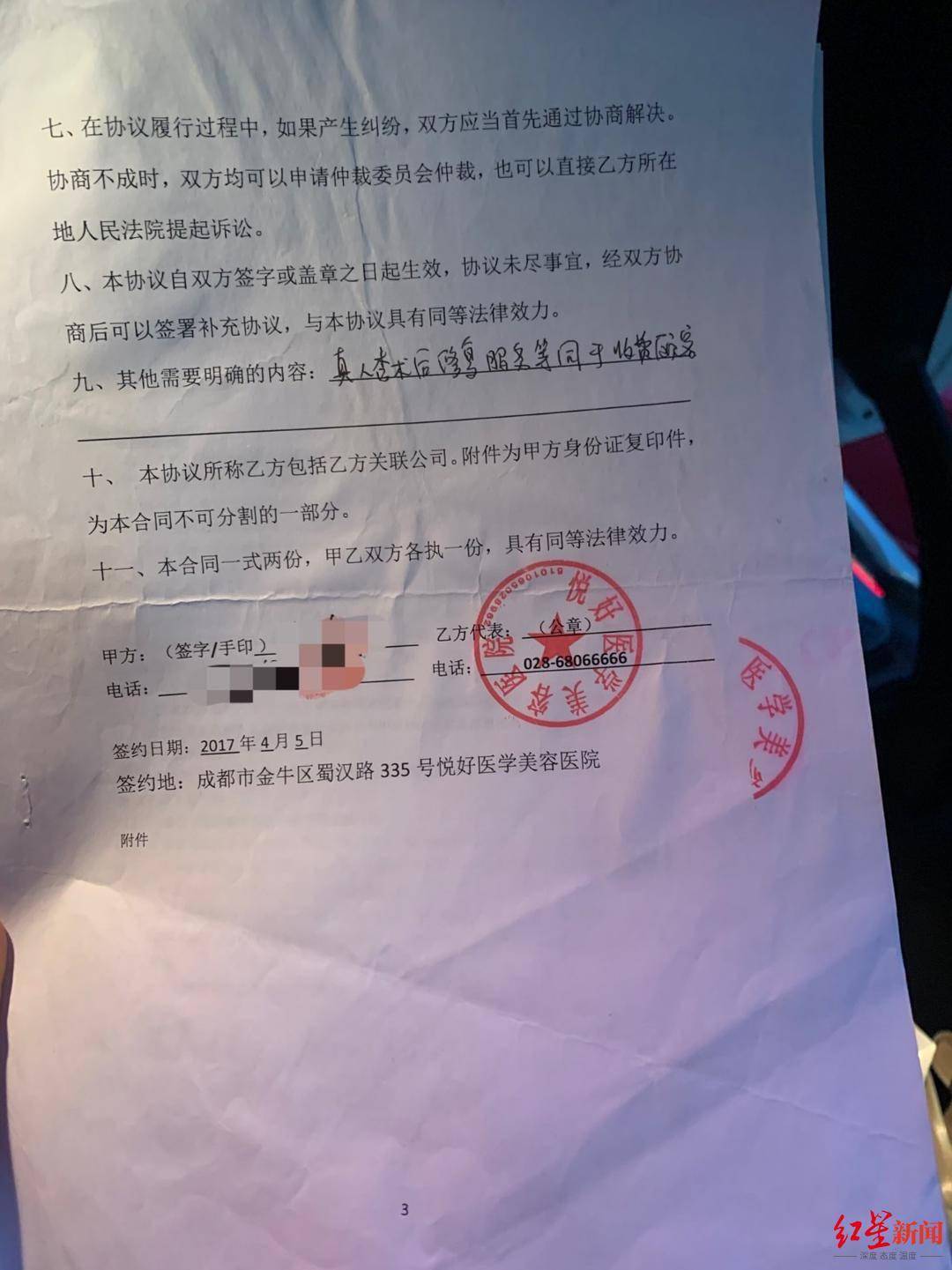 恒达官网整形悲剧:“成都赵丽颖”没当成,鼻子还变形 院方:手术确实出了问题 (图5) 恒达官网整形悲剧:“成都赵丽颖”没当成,鼻子还变形 院方:手术确实出了问题 (图5)