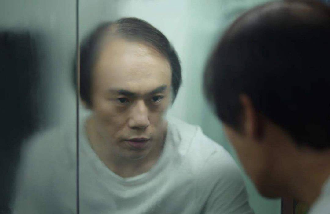 英年早“秃”！90后都开始戴假发了，但看到价格