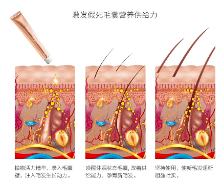 毛囊|流女星们的“狮子头”都是假象？录节目竟然当场掉下假发片，真相竟然是……
