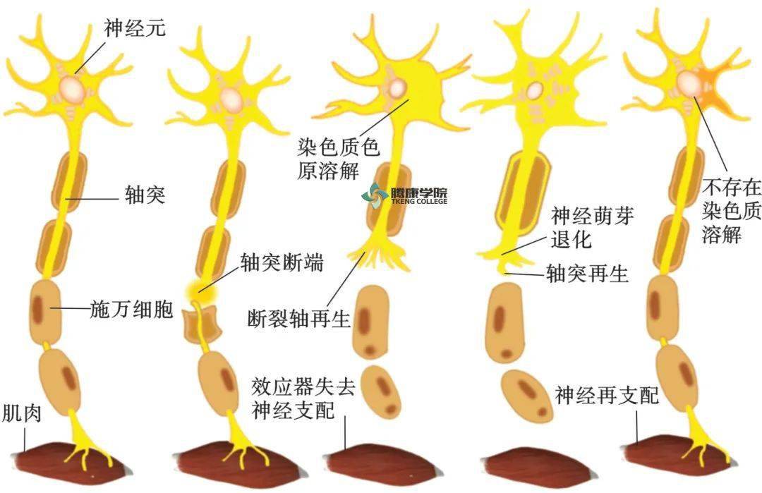 神经纤维的再生