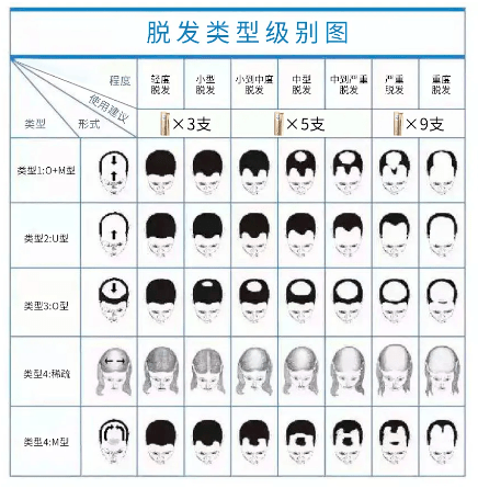 毛囊|流女星们的“狮子头”都是假象？录节目竟然当场掉下假发片，真相竟然是……