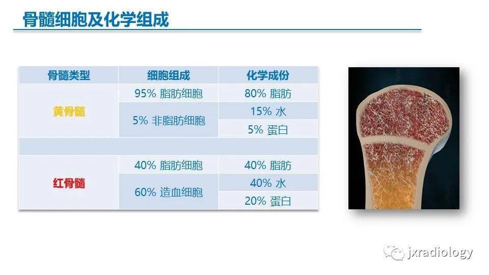 骨髓mr红骨髓黄骨髓和病变mriofbonemarrowredyellowanddiseases