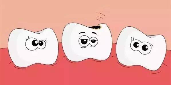 宝宝嘴里的"黑牙齿",通常分为三类  1,龋齿 就是我们常说的  虫牙