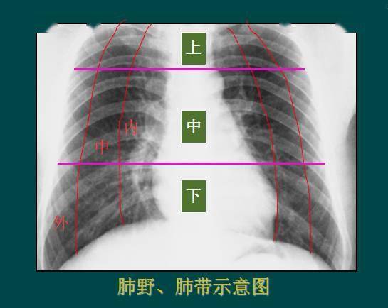 纵隔|读完此文，终于学会看胸片了