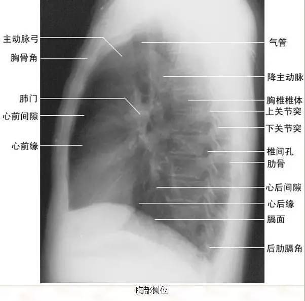 纵隔|读完此文，终于学会看胸片了