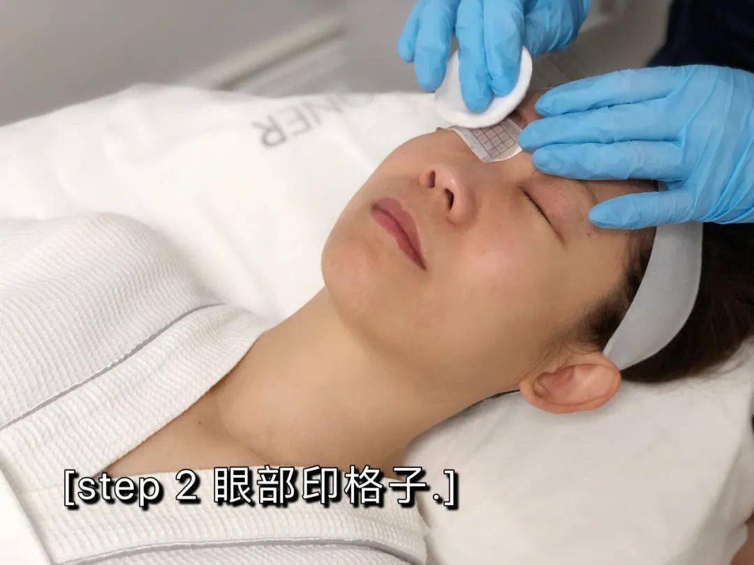 皮肤|热玛吉五代团购第2波丨热玛吉的精髓——眼部450发全纪录