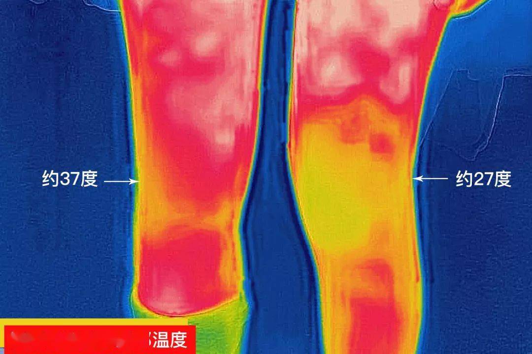 护膝|拒做老寒腿！穿上10分狂升10度，腿部小太阳，穿上秒隐形