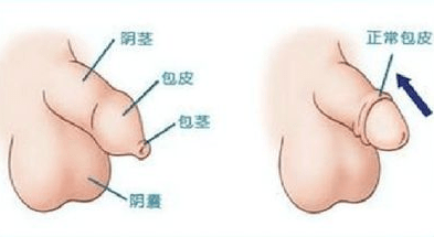 什么情况需要割汗腺 fbd7a315f7a4499aa97e2a6e1c933b83.png