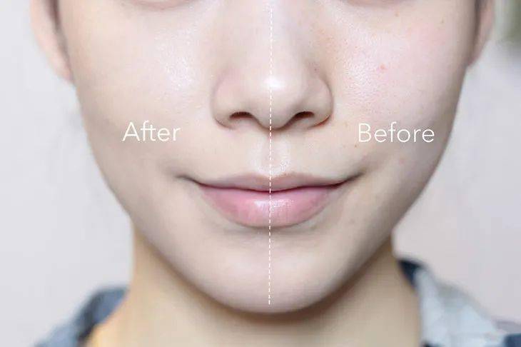 皮肤|毛戈平又放大招，“重返”20岁原来这么简单？