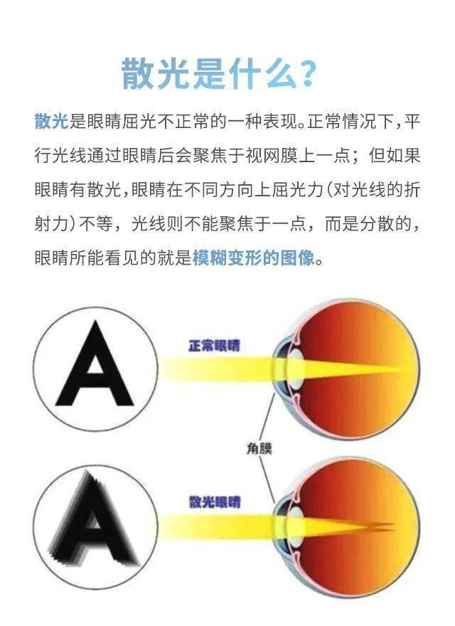 散光什么成语_散光是什么症状(2)