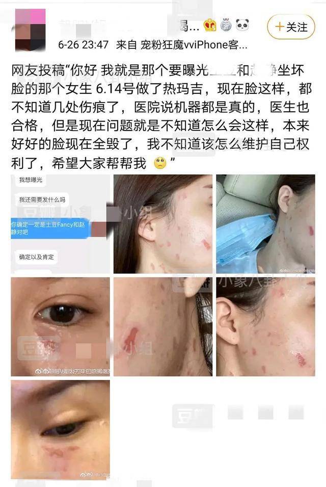 直播|顶着发泡的馒头脸，却自称医美教母，教唆粉丝整容反遭毁容