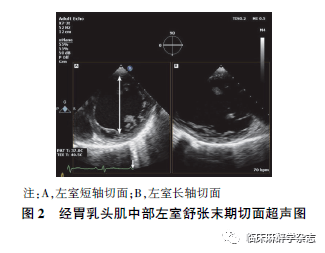 心动图|经食管超声心动图在非心脏手术中应用专家共识 （2020版）