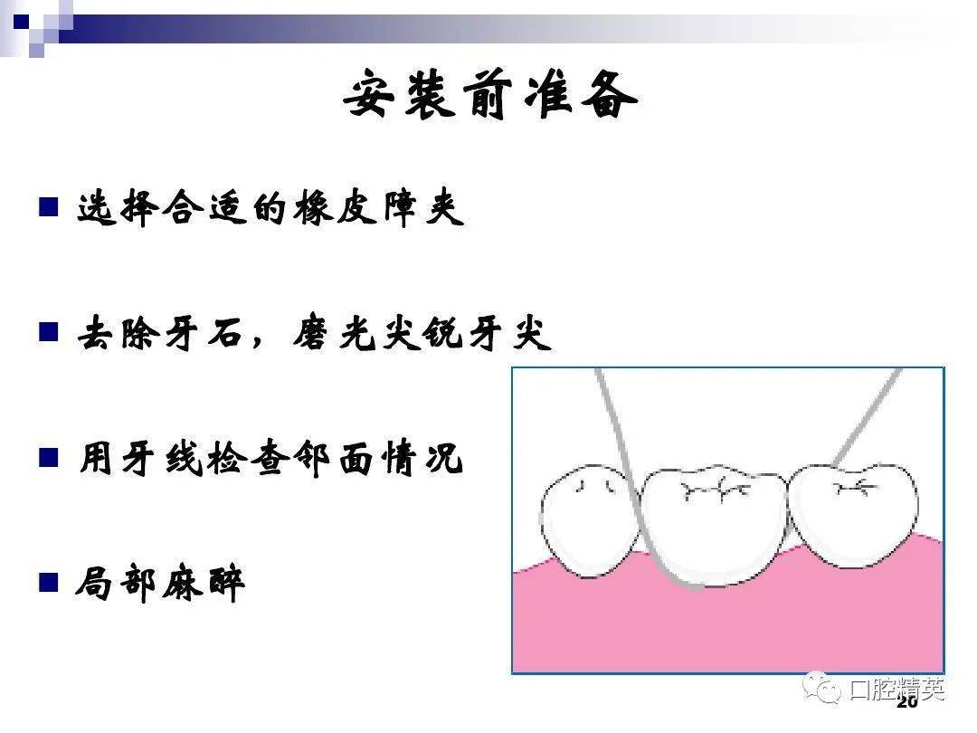 橡皮障的应用