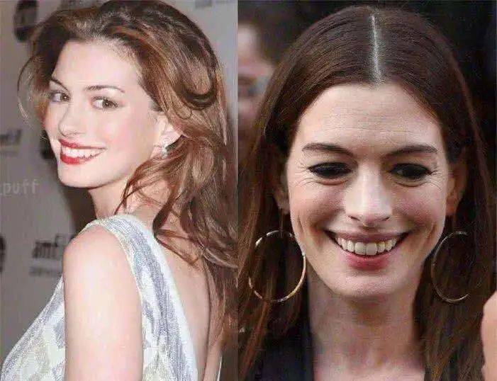 肌肤|嫩到掐出水！用一次比敷100片面膜还白润，10分钟感受女星同款水光肌！