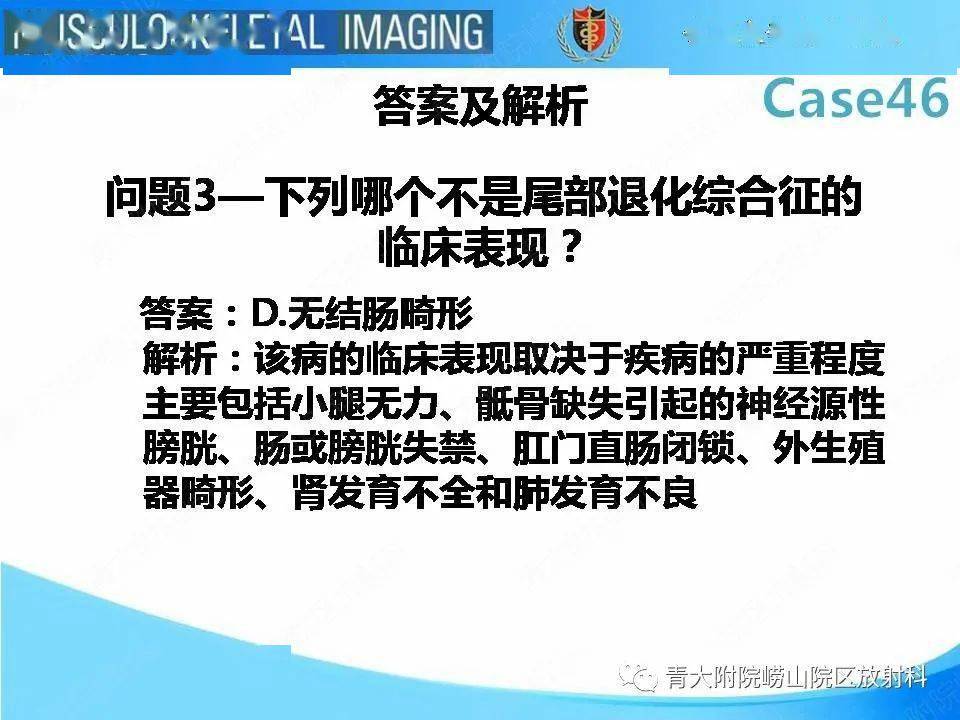 尾部退化综合征