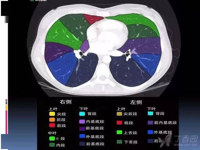 ct入门:肺叶分段,支气管,肺动脉 ct 图谱全在这