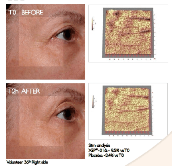 近照|曾经红极一时的“最美港姐”近照曝光，原来美人真的能被一个细节毁掉.......