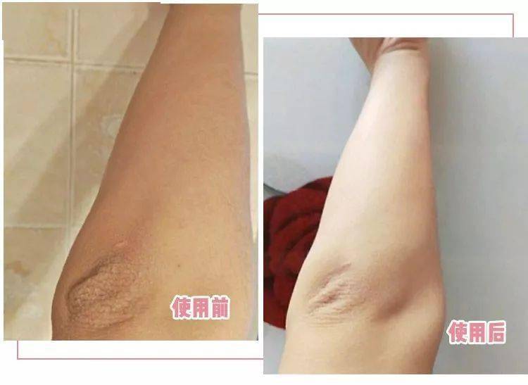 手臂|身体这个部位，男生怕它细，女生怕它粗.....