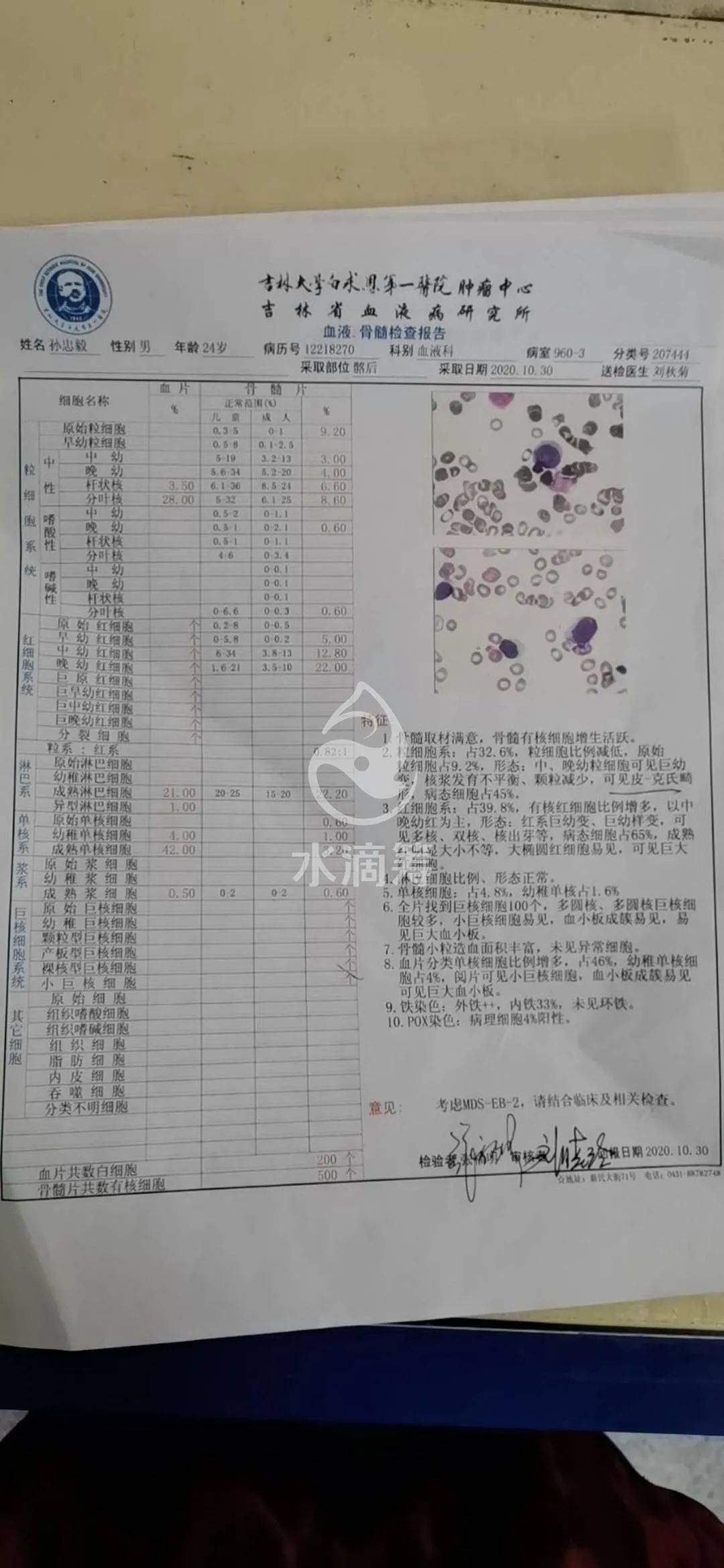 延边爱心接力!本地24岁青年确诊骨髓增生异常综合征!