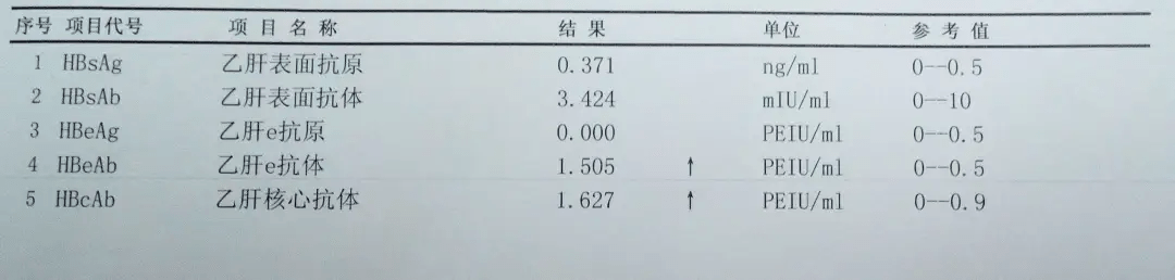 教你轻松看懂乙肝化验单