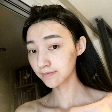 皮肤|杨幂早期合照见心机？看完原图呆了，她们这么早竟都整了...