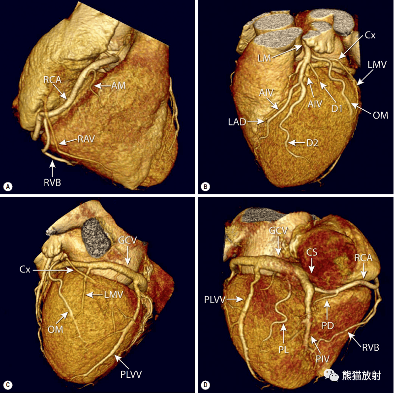 格艾选读丨冠状动脉ct:相关概念,解剖