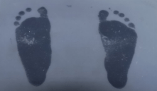 如何判断是不是扁平足图片 46330bc73b6c4b6a9191315b2be45e88.png