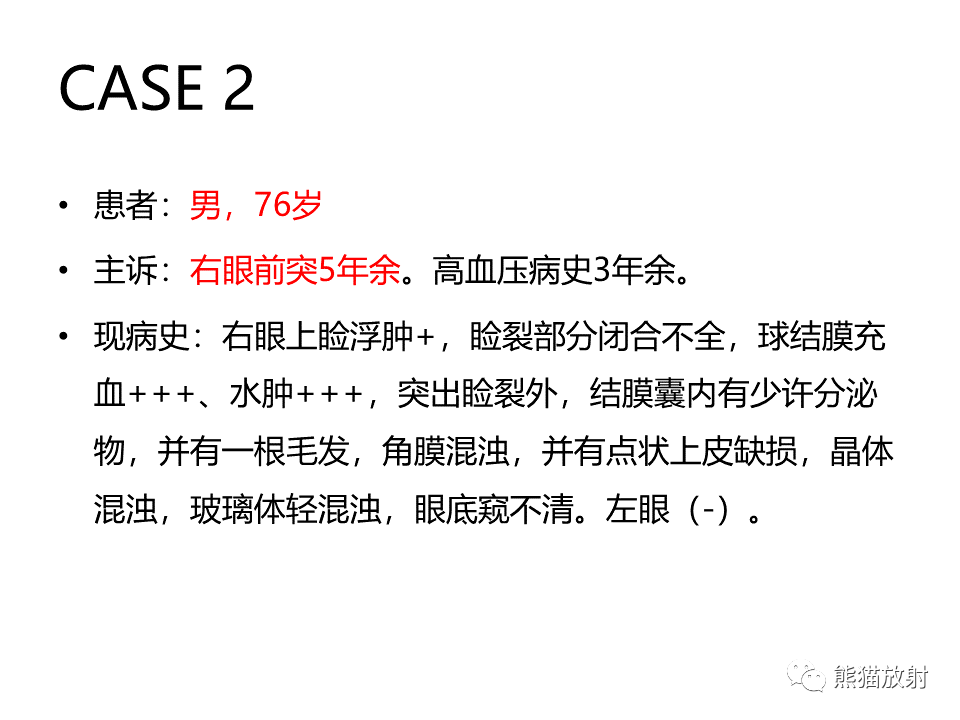 眼眶绿色瘤,淋巴瘤解剖丨颅面颈部(颅面骨,眼眶,腮腺,等)返回搜狐