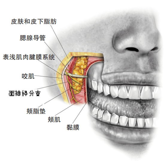 腮腺导管位置的颊部截面图,显示颊脂垫