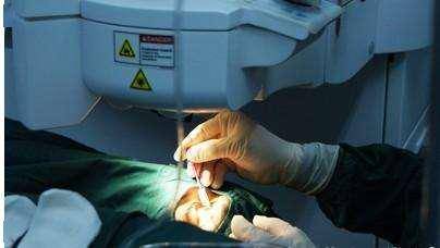 激光近视手术需要哪些准备 9a6a8433b2d94c118922dcd3c955612d.jpeg