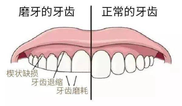 孩子|肚里有寄生虫？缺微量元素？宝宝夜磨牙