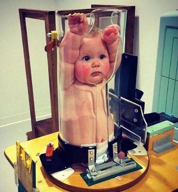 几个月出现肠胀气 b137ae940d07404fb3ab49bfc6946354.jpeg