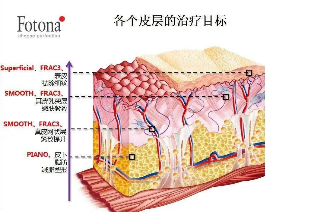 时代十年重磅入驻丨欧洲之星fotona4d多维立体抗衰新秀