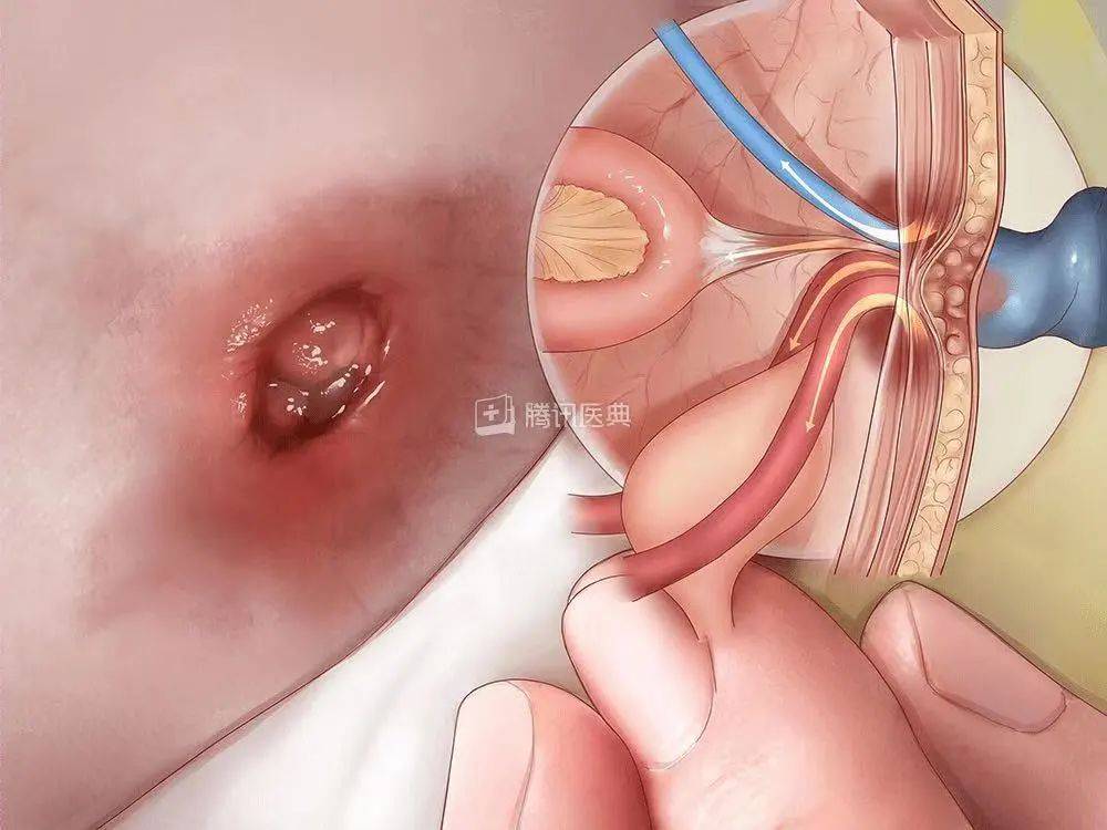 女人|女人身上的这个“洞”，千万别乱抠，后果很严重