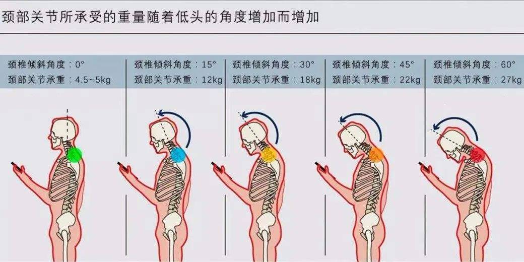 新品类新机遇戴立舒03护颈功能眼镜来了