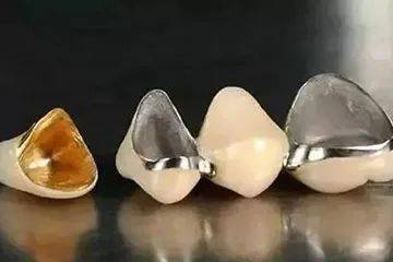 烤瓷牙与全瓷牙的区别和优缺点
