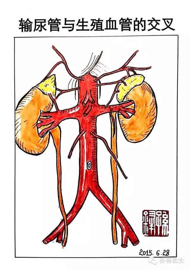 医学笔记|输尿管局部解剖中的三个"3"(原创图文)