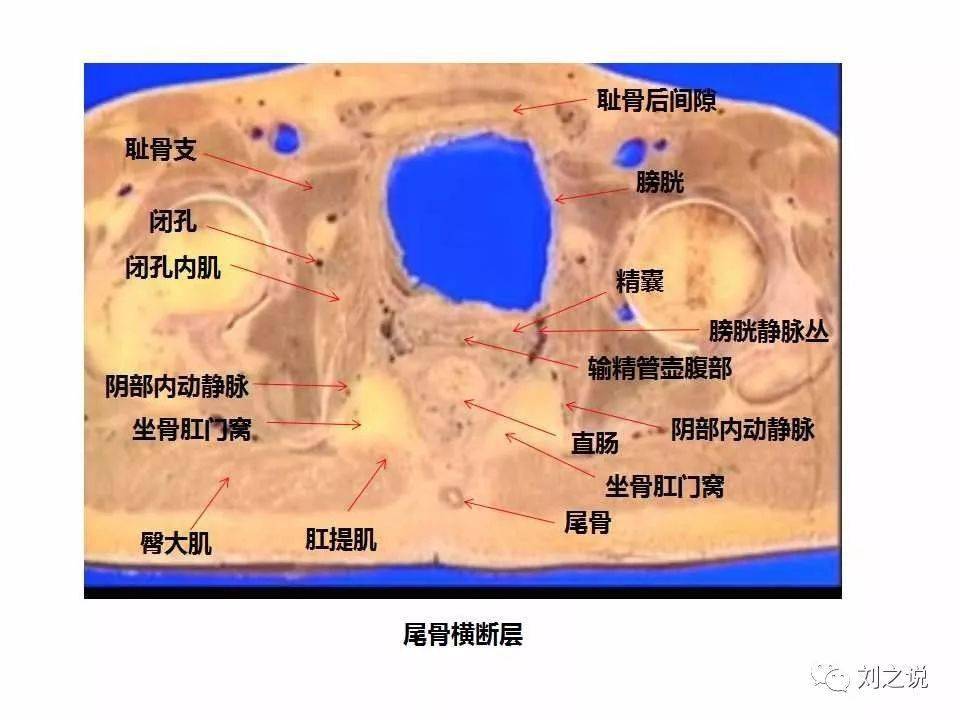 收藏必备:男性盆腔断层解剖