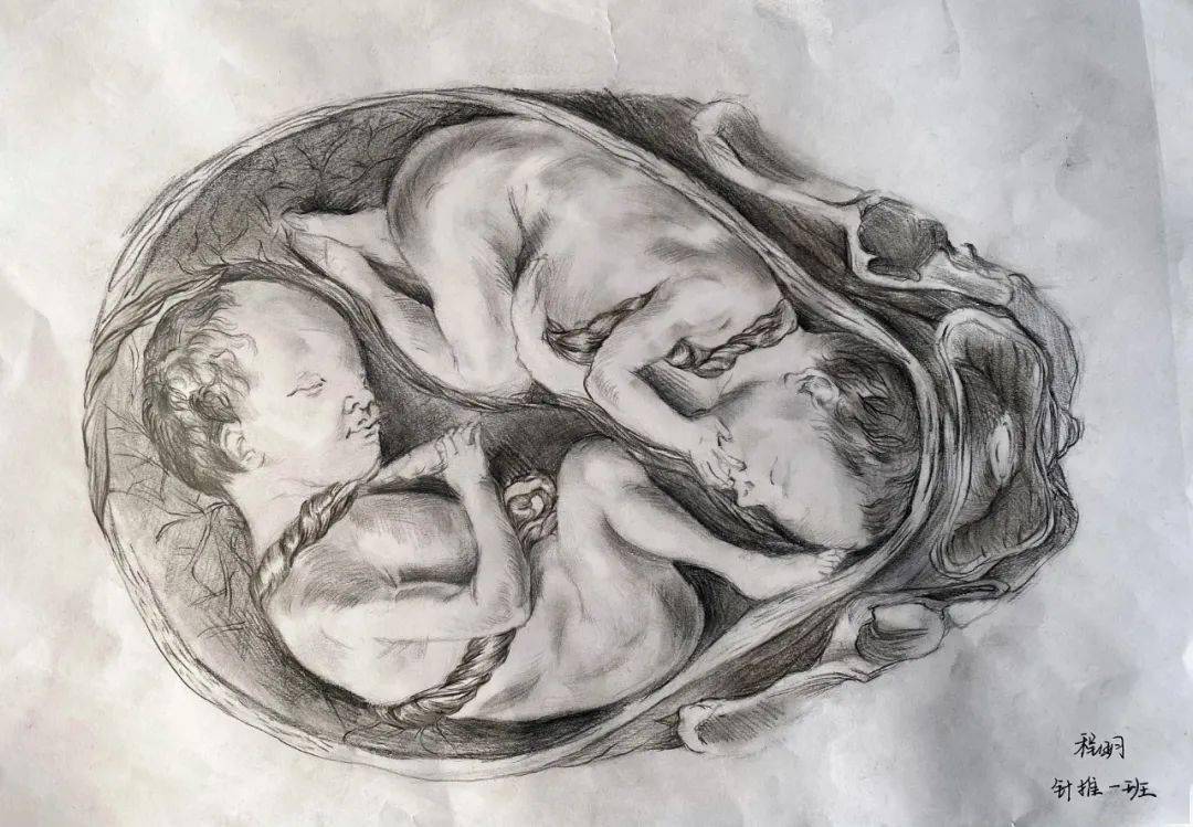 本作品运用素描的手法生动形象的展现出了头颈部右侧面的肌肉的组成