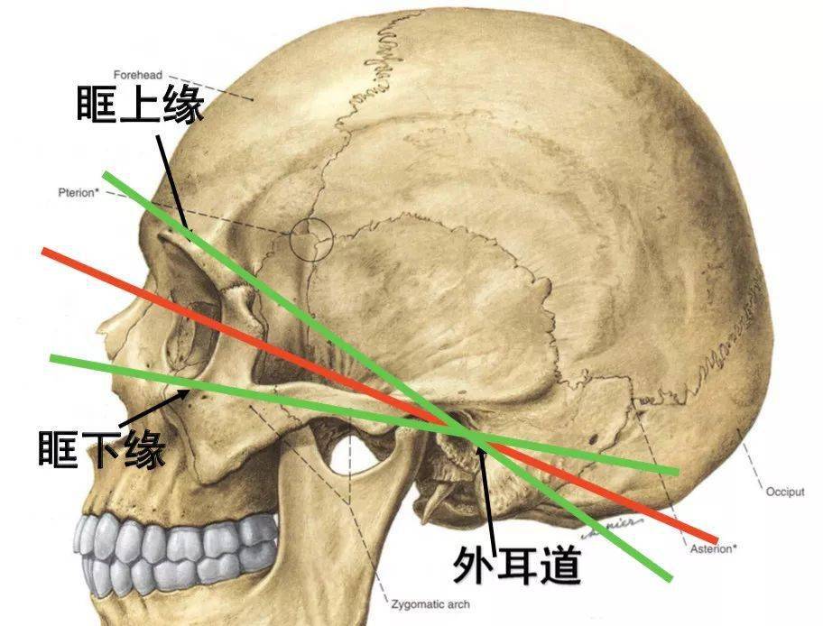 为外耳道中点与眶上缘中点的连线,经该线的平面约与颅底平面一致,有
