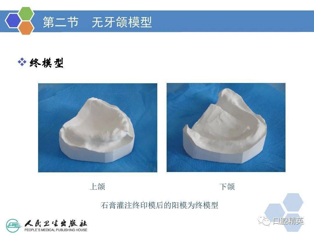 全口义齿印模制取及颌位关系记录