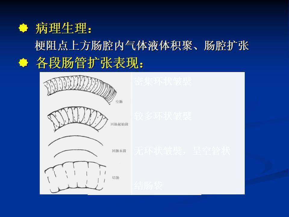 高清图片文字讲解肠梗阻的分类及影像学表现