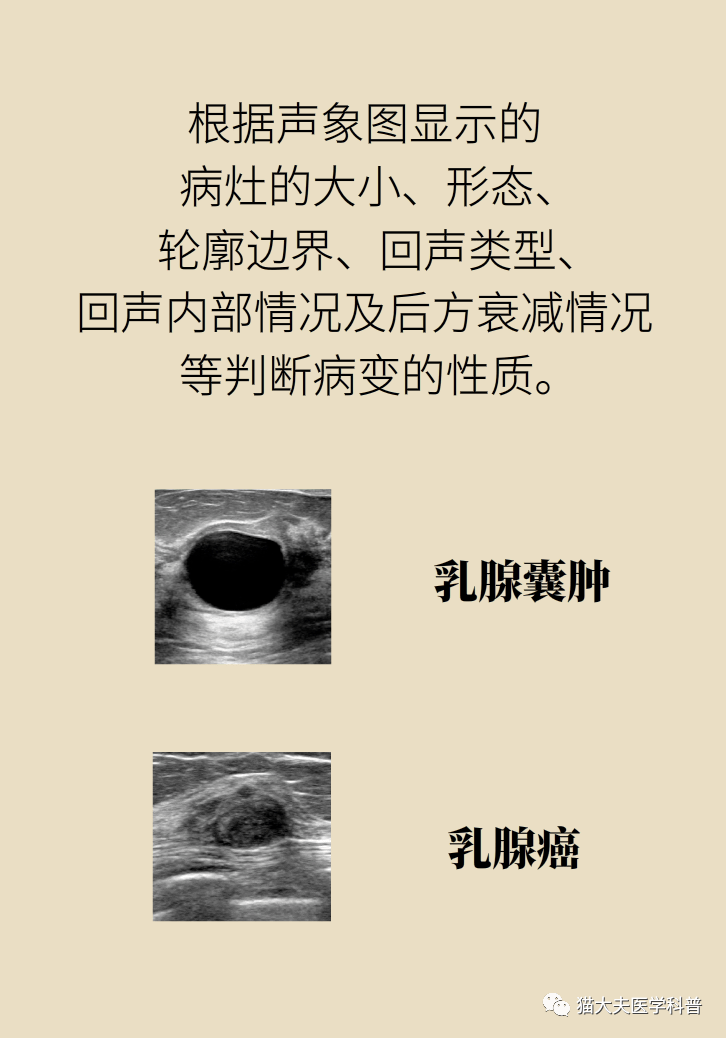 钼靶和b超,检查乳腺选哪个?