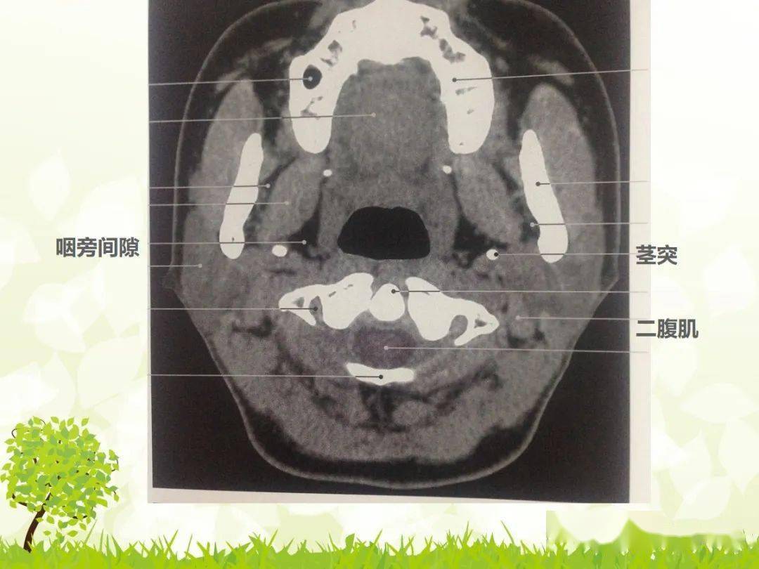 让癌症原形毕露的医学影像检查CT/MRI/PET等：概述篇 - 知乎