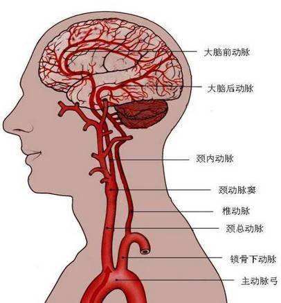 针刀治疗脑血管病后遗症的详细论述