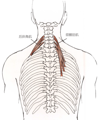 颈髂肋肌,后斜角肌