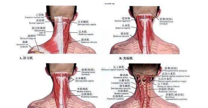 护士:颈后大包如何系统康复纠正?_肌肉