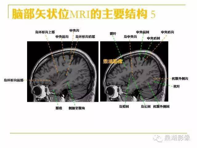 值得收藏!高清头颅mr解剖图谱