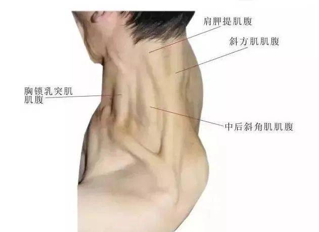 打什么针可以消掉斜方肌 613d3cf5ae7f4478b66506ed5aa2e96c.jpeg